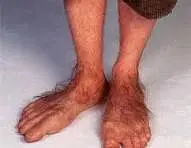 My feet